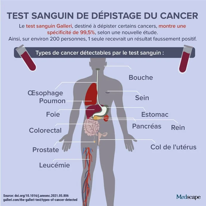 Le test sanguin Galleri, qui peut détecter jusqu'à 50 types de cancer différents, est désormais proposé dans différents contextes oncologiques